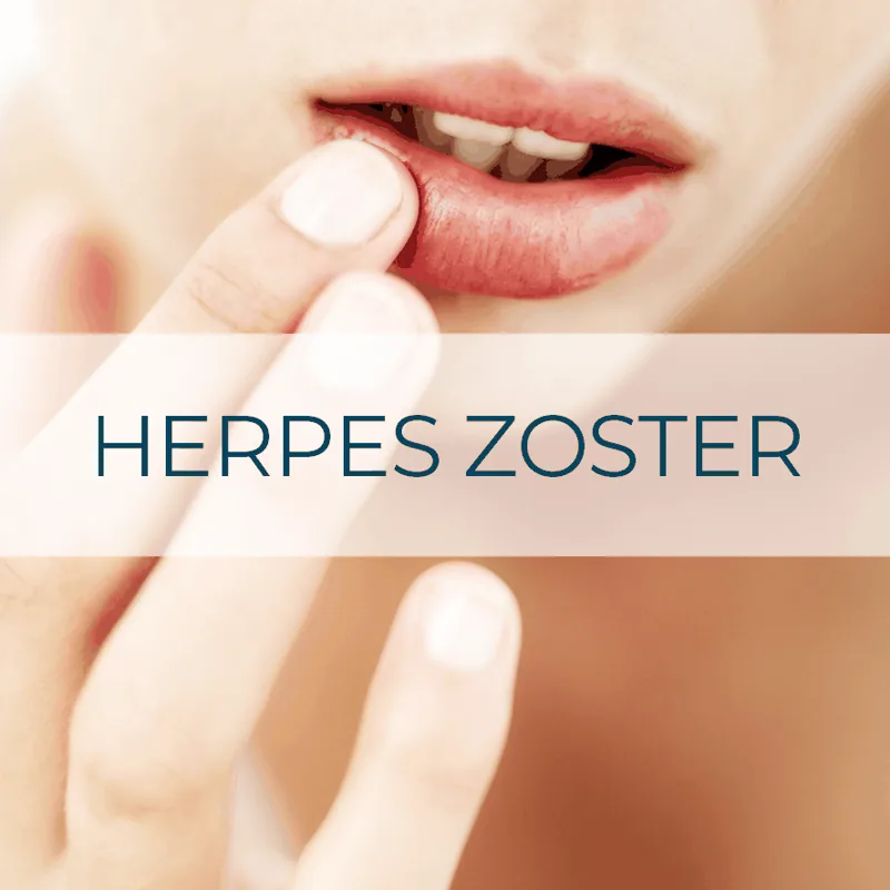 Vacuna Herpes Zóster